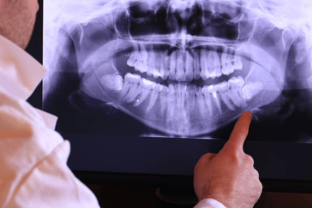 Best Emergency Treatment for Oral Infections in Etowah, NC